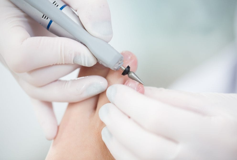 vragen aan de pedicure